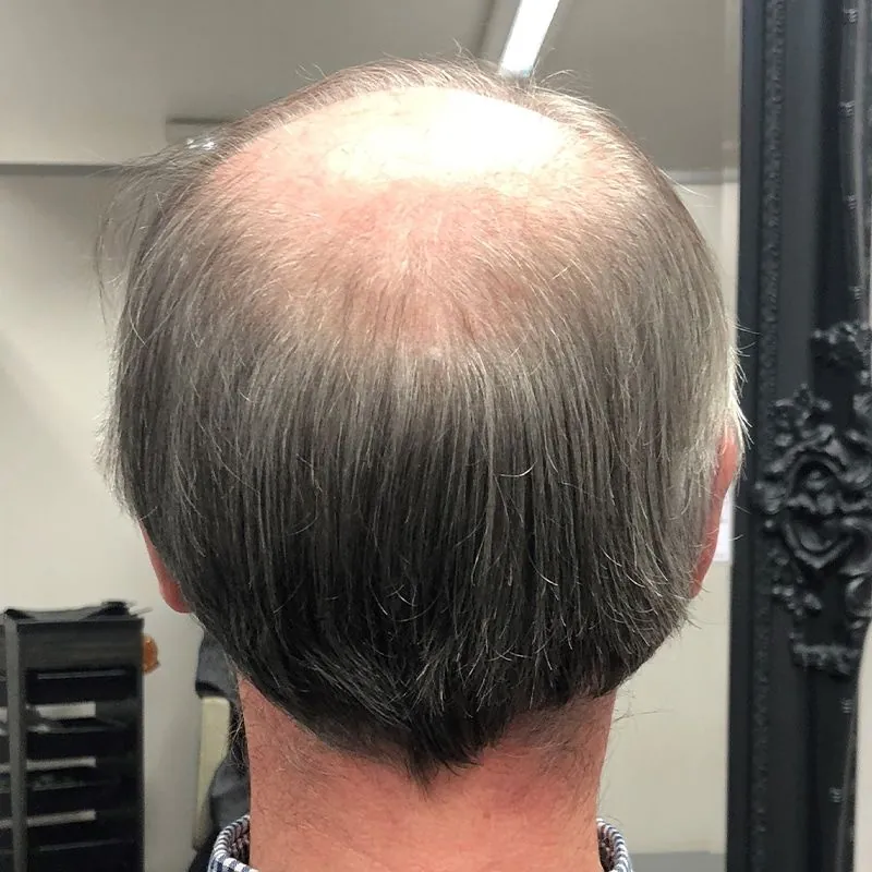 Client 01 before their hair system